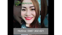 Bọc sứ răng hô tại Nha khoa quốc tế Á Châu Bọc sứ răng hô tại Nha khoa quốc tế Á Châu