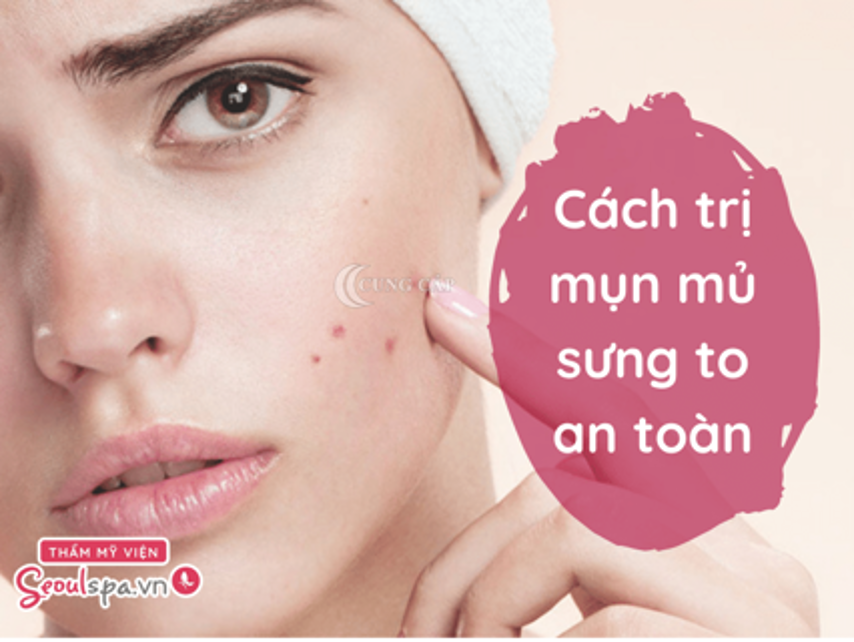 tri mun mủ sung to an toàn