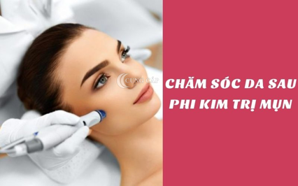 các bước chăm sóc da sau phi kim trị mụn
