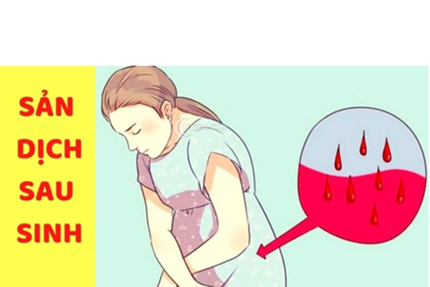 5 triệu chứng của ứ sản dịch sau sinh mổ mẹ nên biết